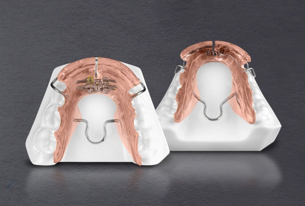 Airway-Focused Functional Appliances