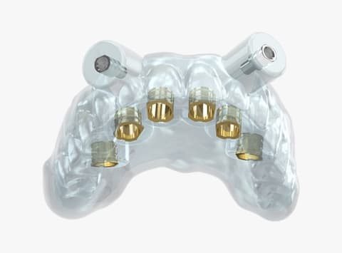 Guided implant surgery