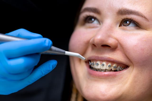 Braces versus clear aligners comparison