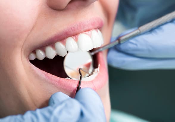 Bleeding gums and gum health